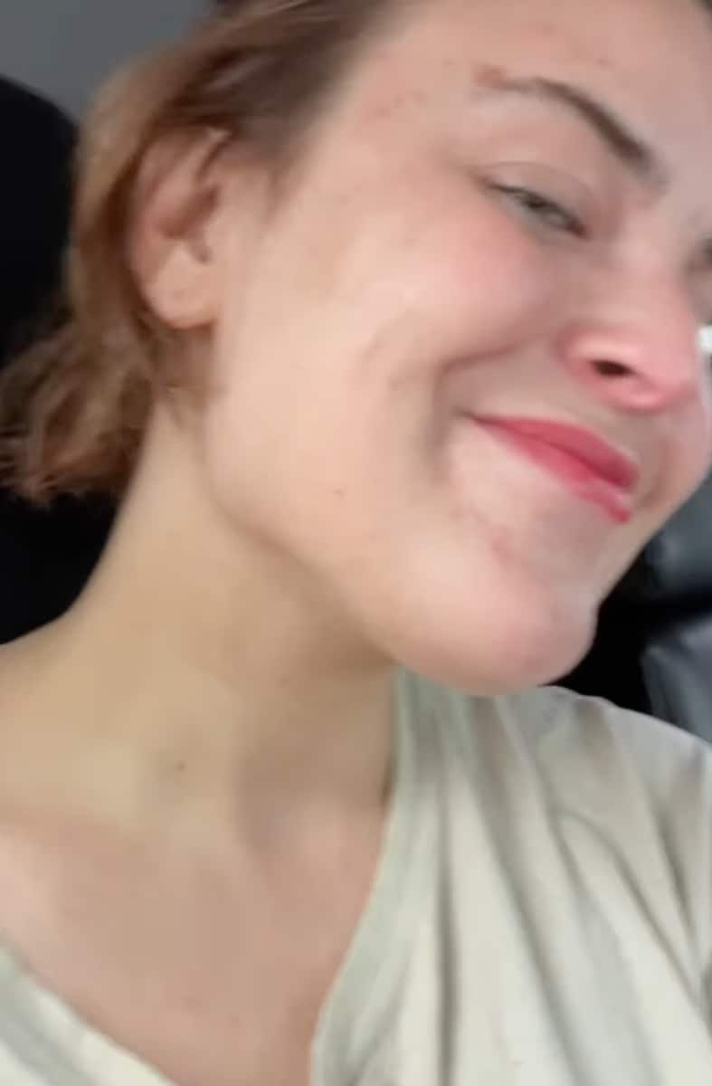 Bruce Willis' daughter, Tallulah Willis, reveals the obsessive-compulsive disorder that led her to have marks on her skin.