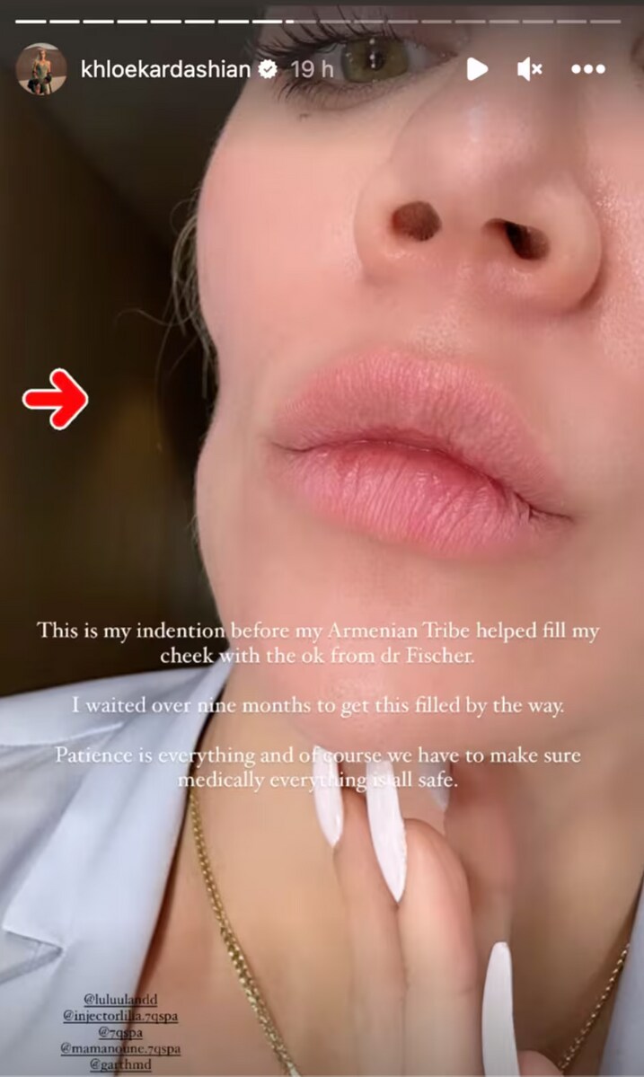  Khloé Kardashian's health scare. 