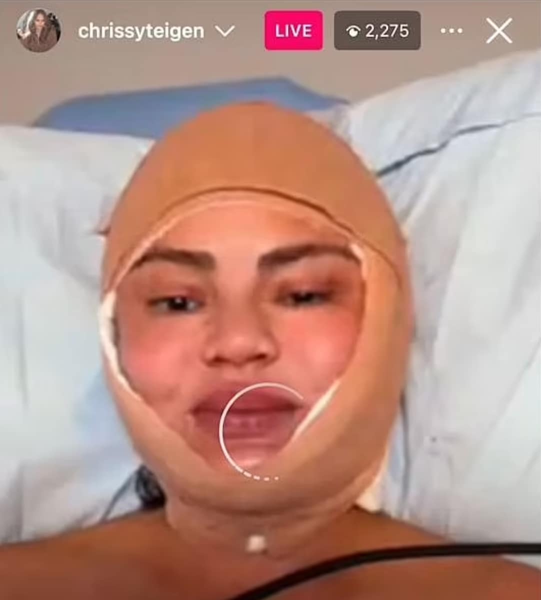 Chrissy Teigen 