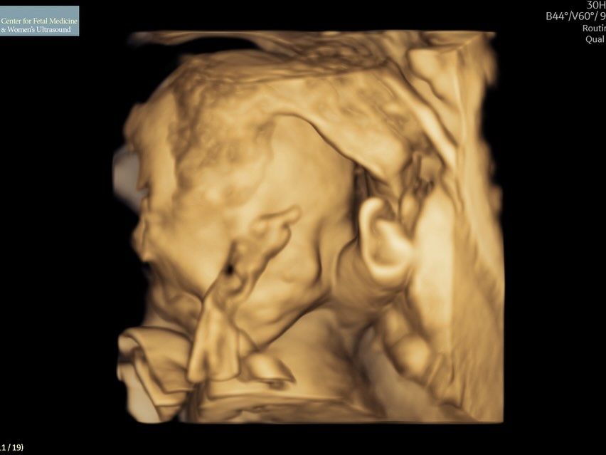 The unborn child appeared to be flipping off the sonogram 