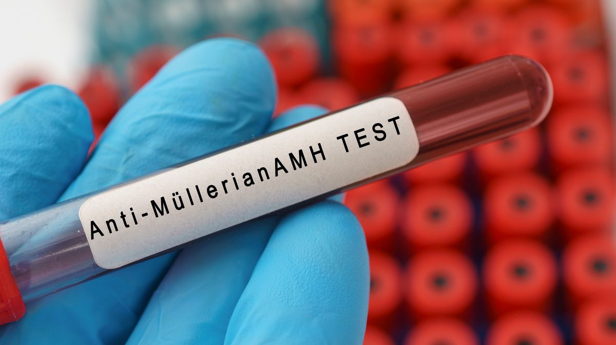 AMH has become one of the most discussed fertility tests, but experts say it is also one of the most misunderstood.