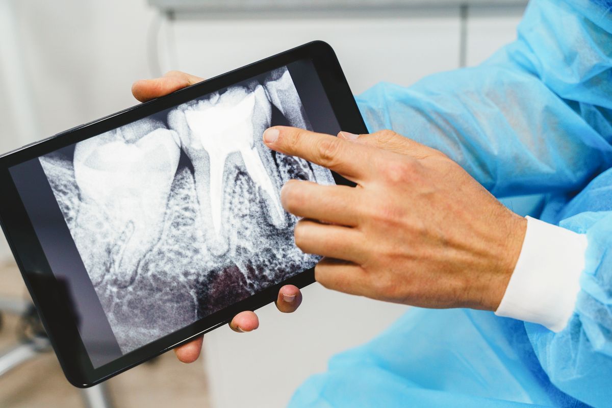 Aguilera says dentists can sometimes recognize a characteristic erosion pattern