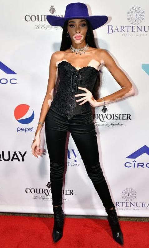 Winnie Harlow en encaje
