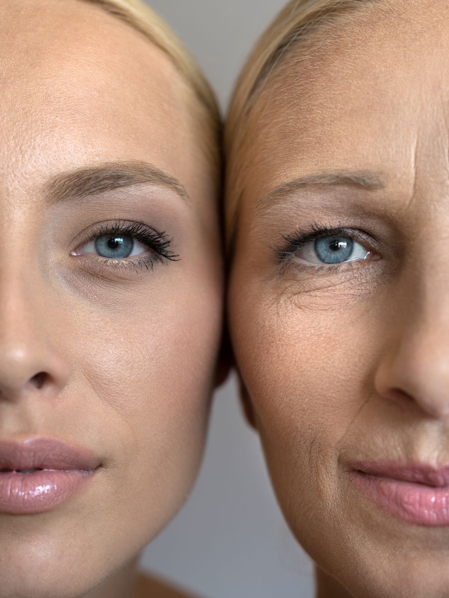 Dr. Shafer says the cheeks and jawline are often where people notice changes first