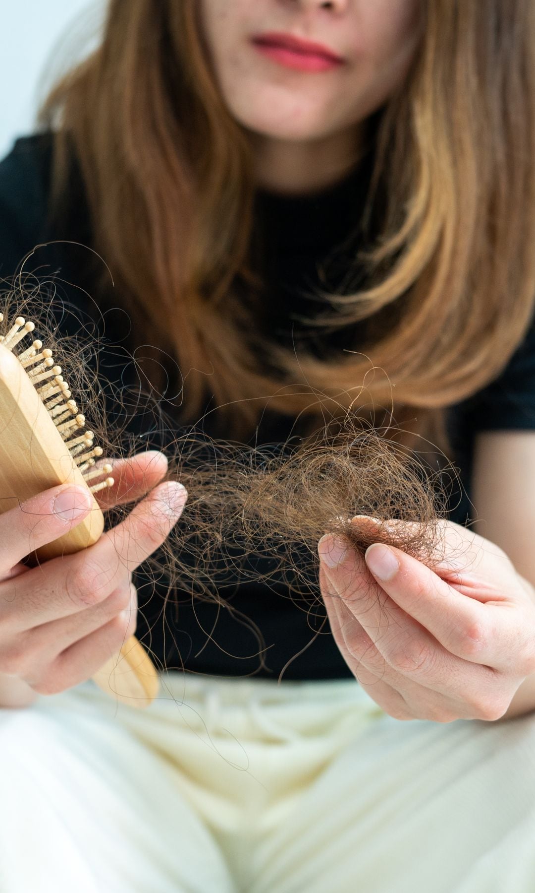 Hair loss treatment: New cream could end balding for good