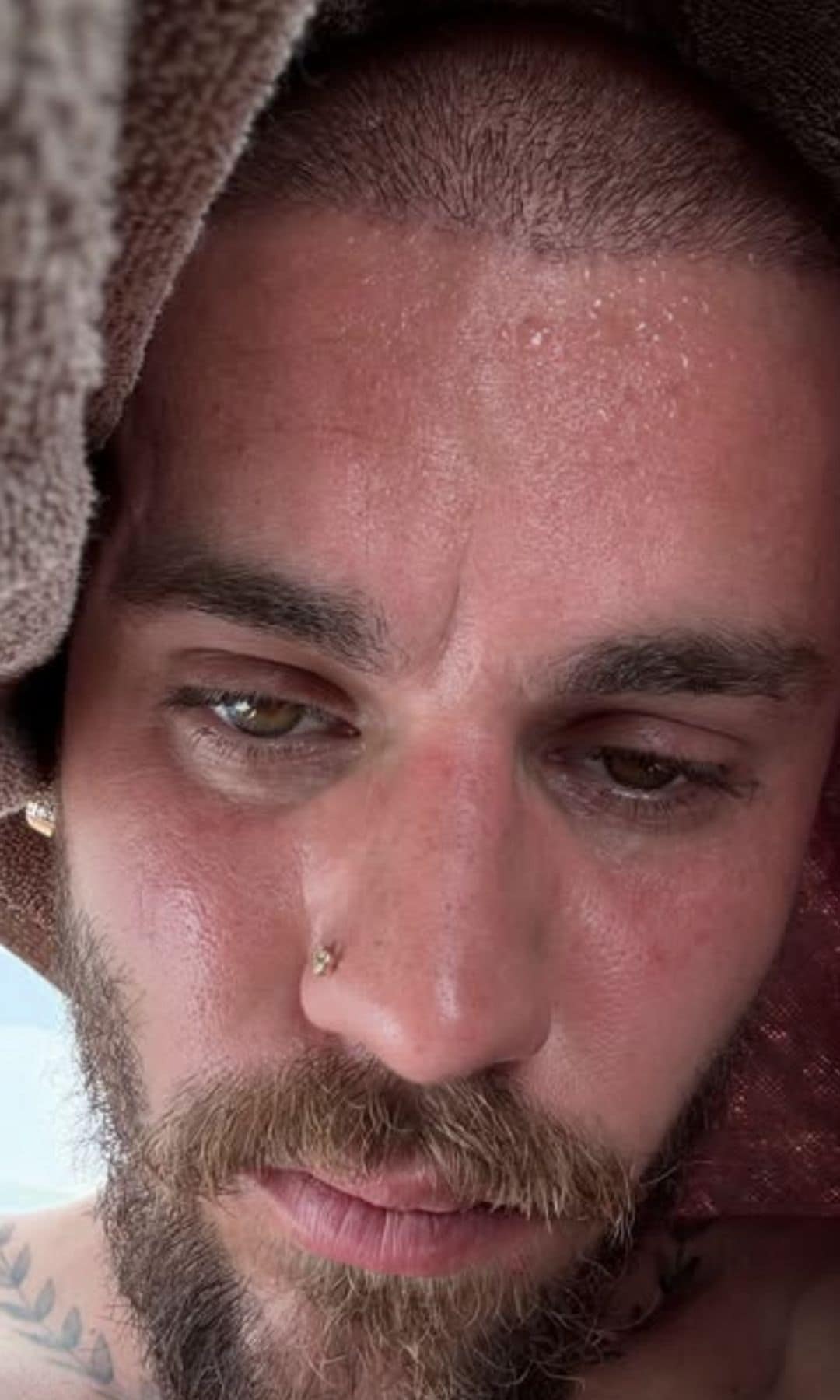 Justin Bieber shared a selfie, claiming to be detoxing