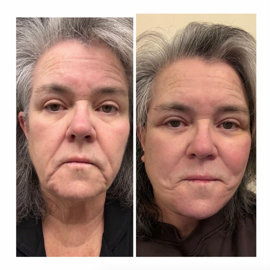 Rosie O’Donnell says her facelift cost more than any car she’s ever bought