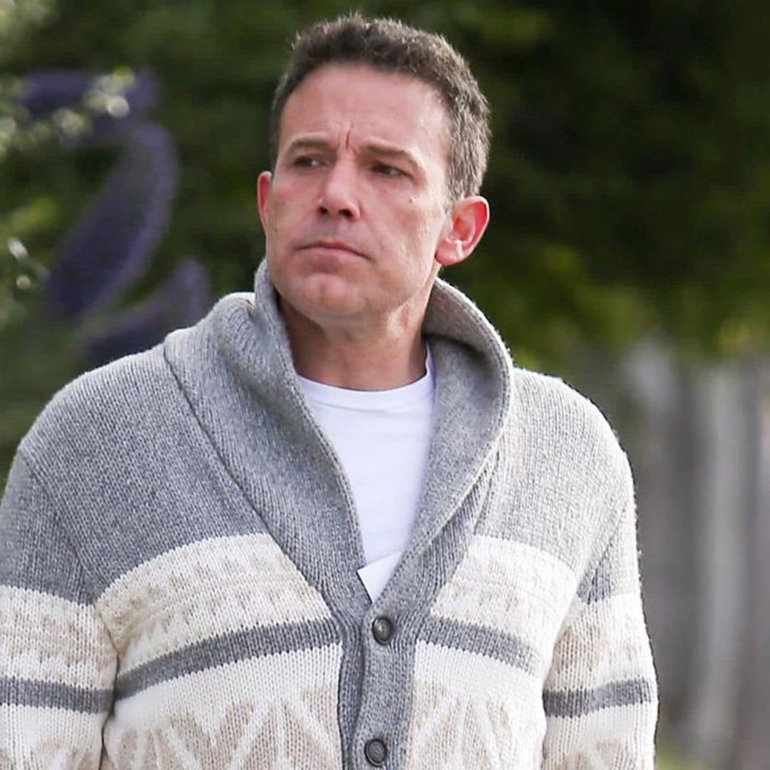 Did Ben Affleck undergo plastic surgery?