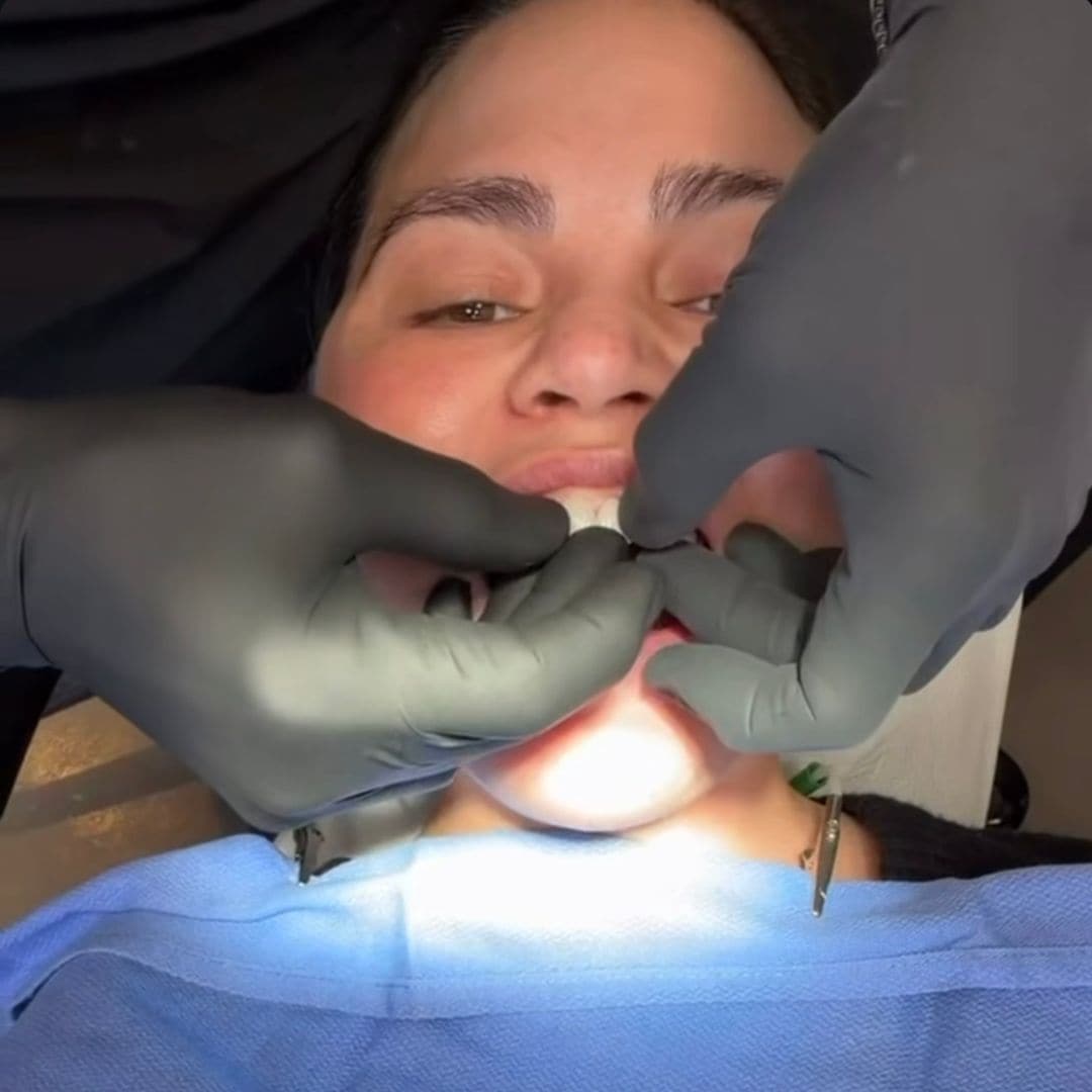 Chrissy Teigen gets her tooth put back on after candy cane project goes horribly wrong