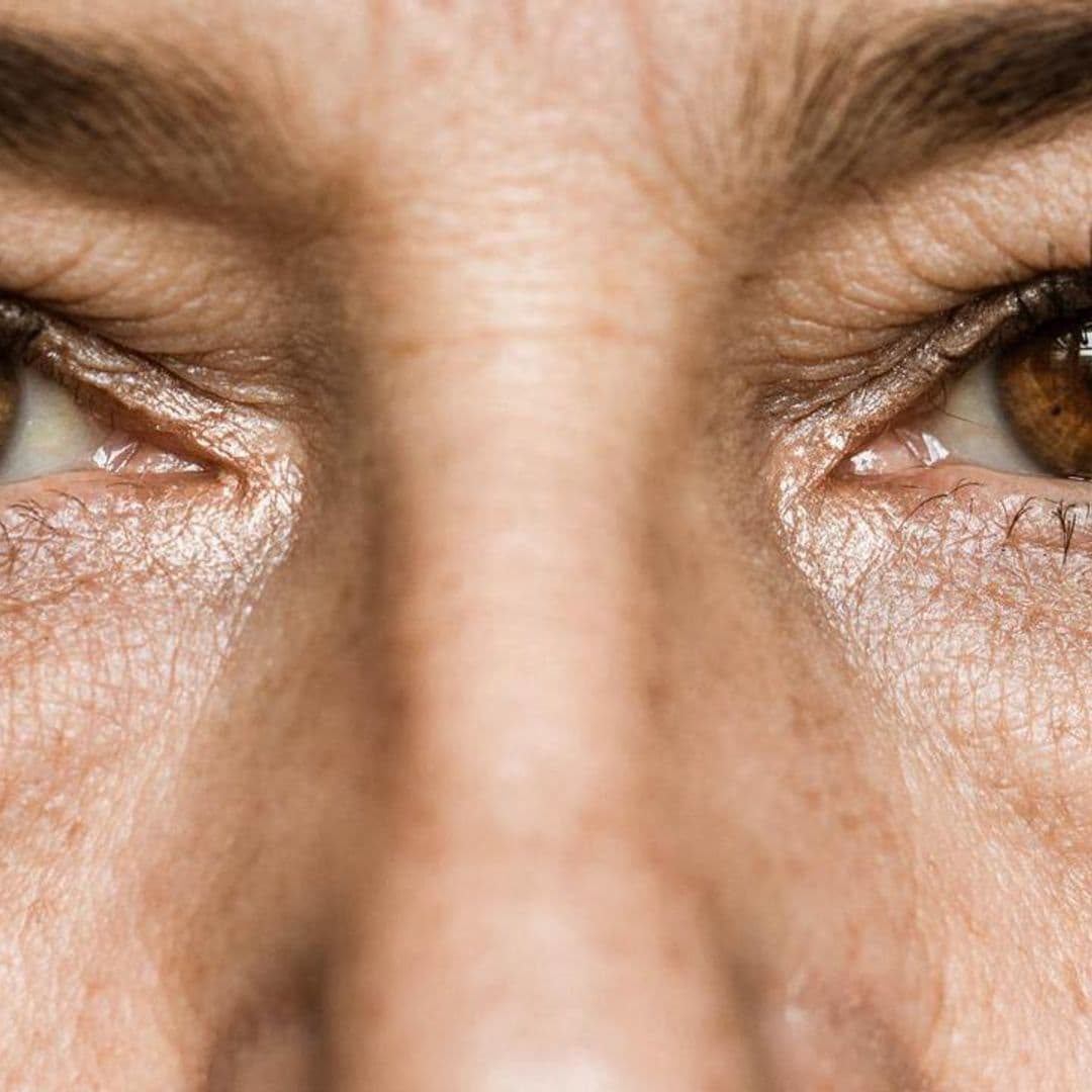 What is Estrogen Deficient Skin and how to repair it non-hormonally