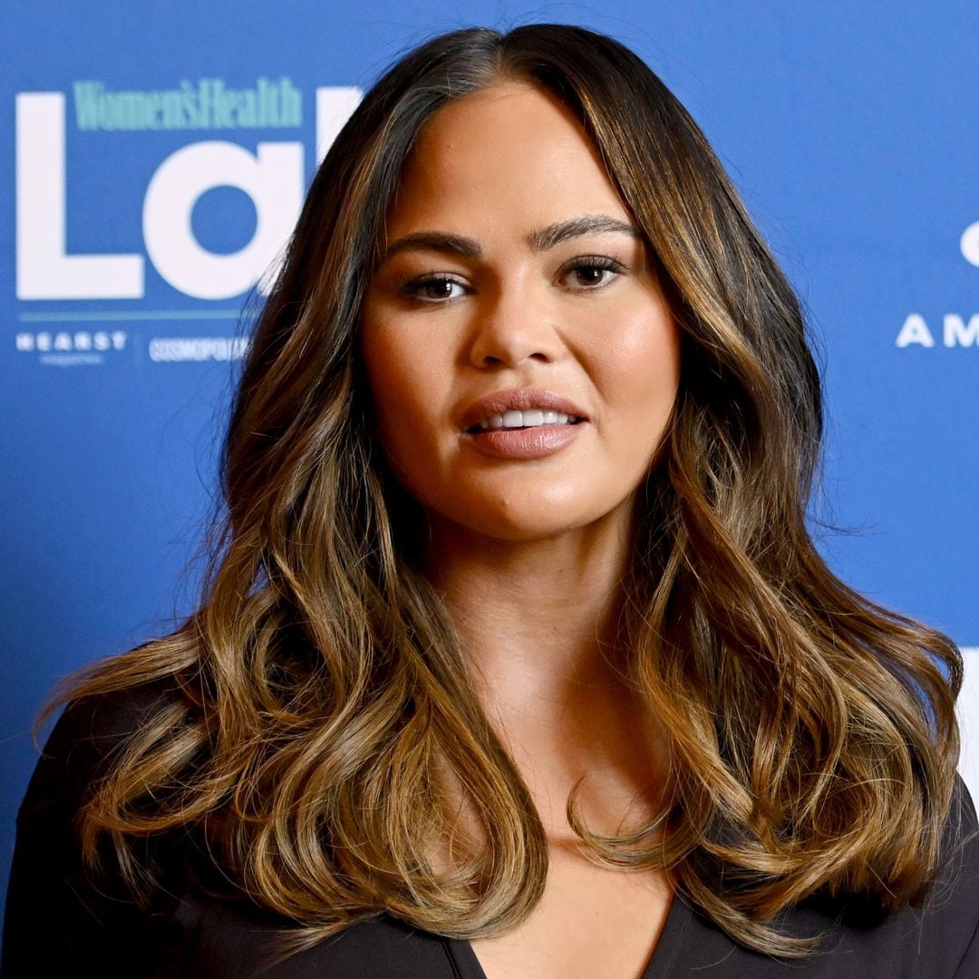 Chrissy Teigen goes live with a shocking bandaged face and explains nothing