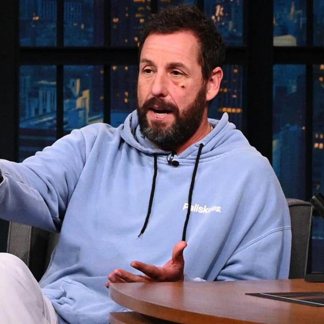 How Adam Sandler got a black eye from a bizarre accident in bed: ‘It was bleeding all over’