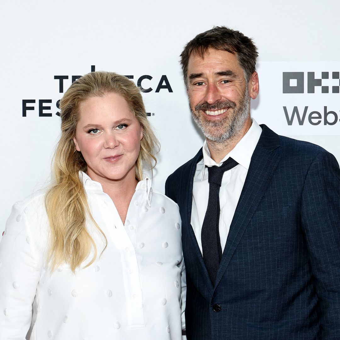 Amy Schumer and husband Chris Fischer divorcing after 7 years of marriage