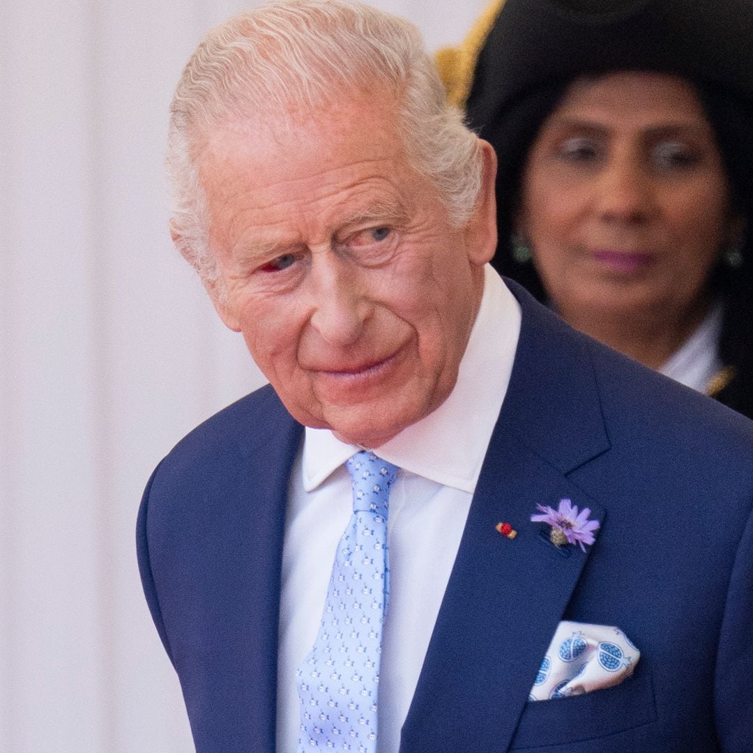 King Charles steps out with bloodshot eye—what happened?