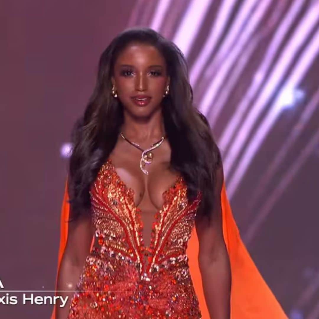 Nuevos detalles sobre Miss Jamaica; revelan la verdad sobre su estado de salud y aseguran que pronto será dada de alta