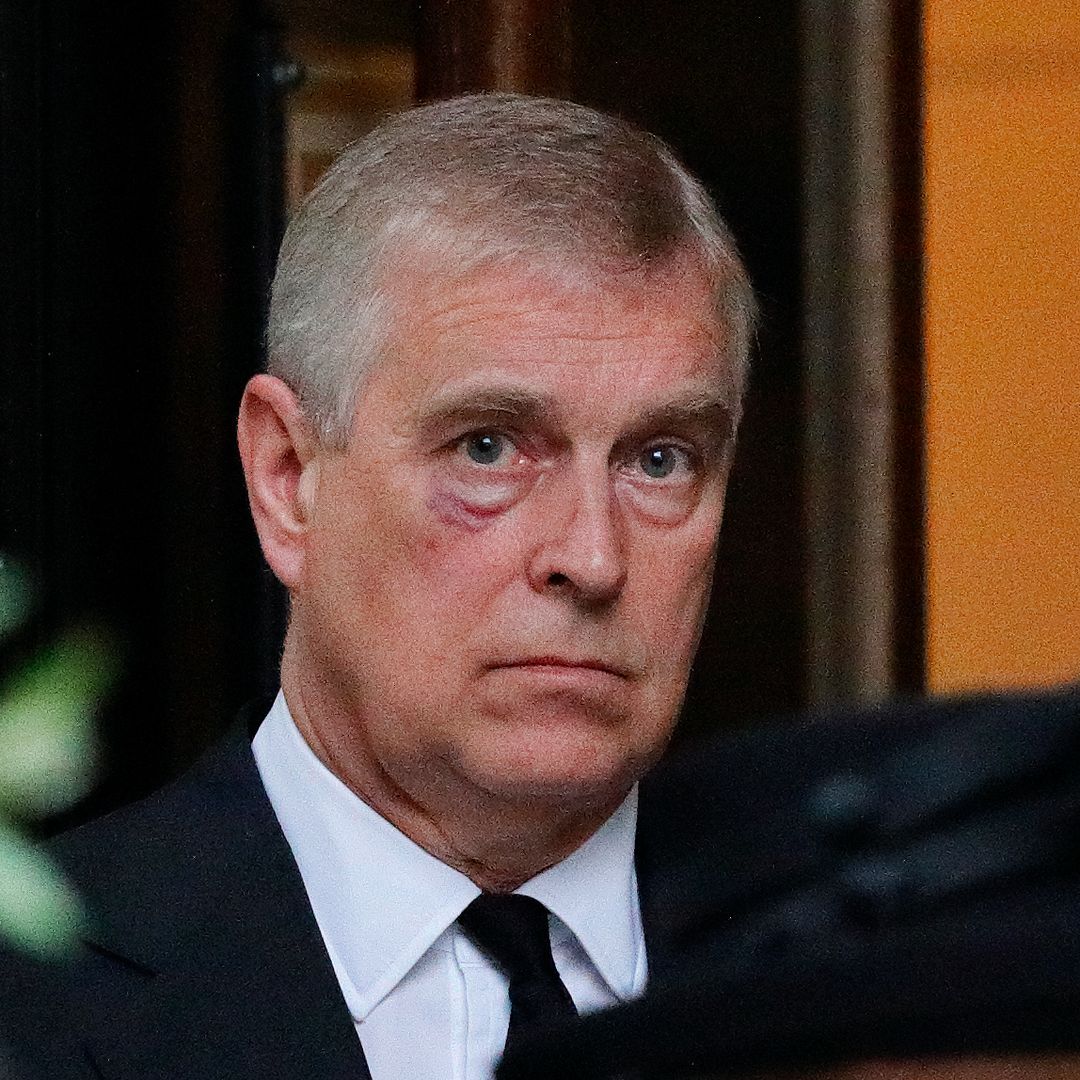 The real reason Prince Andrew was spotted with a large bruise on his face revealed