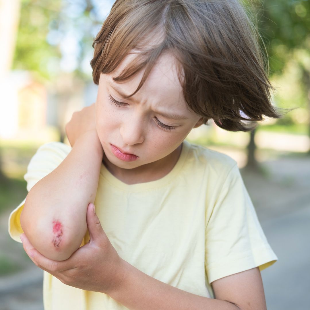 What is Lymphangitis? Symptoms, causes, treatment, and when it becomes dangerous in children