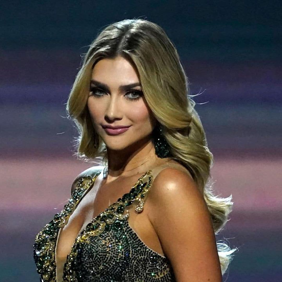 Miss Universe Colombia loves her imperfections in new post