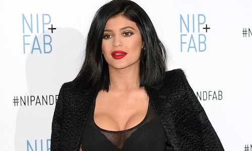 Kylie Jenner finally admits to using 'temporary lip fillers'