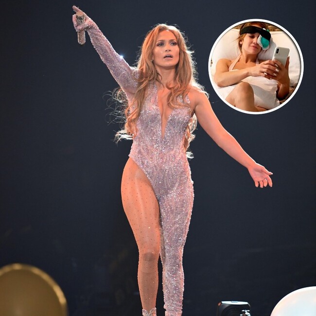Jennifer Lopez da detalles sobre el aparatoso accidente que sufrió durante un show
